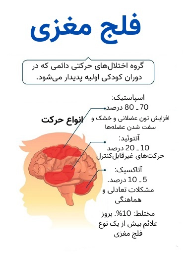 کلینیک فیزیوتراپی و توانبخشی رادان - فلج مغزی