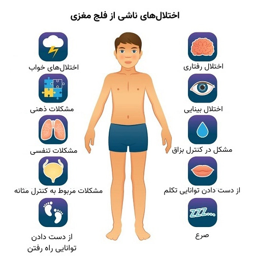 کلینیک فیزیوتراپی و توانبخشی رادان - فلج مغزی