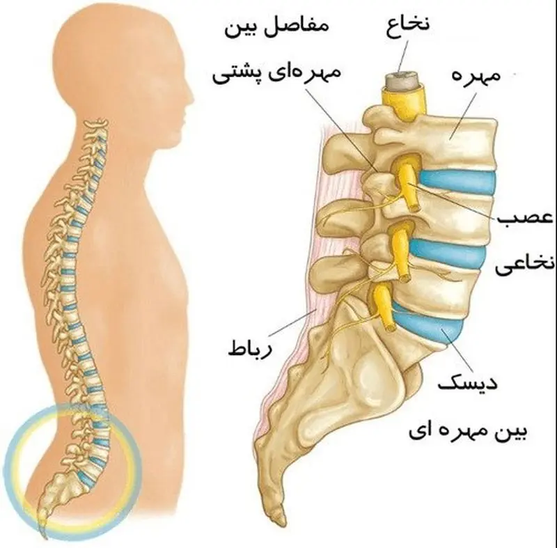 دیسکوپاتی ستون فقرات - کلینیک فیزیوتراپی و توانبخشی رادان