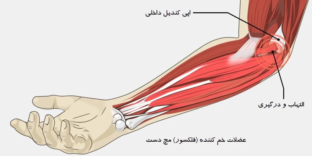 گلف البو - کلینیک فیزیوتراپی و توانبخشی رادان