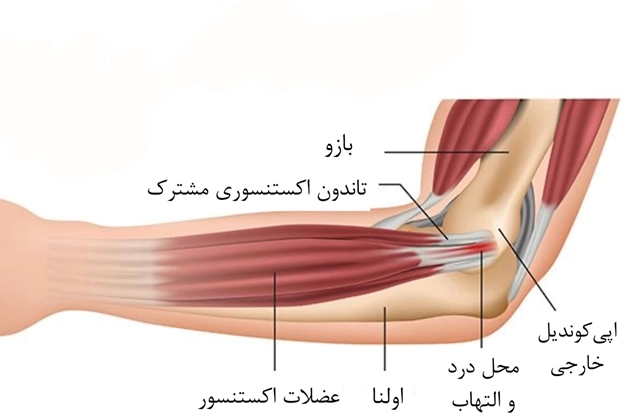 گلف البو - کلینیک فیزیوتراپی و توانبخشی رادان