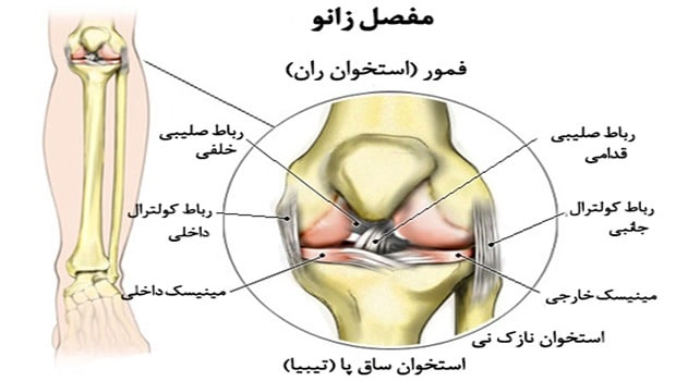 رباط صلیبی قدامی - کلینیک فیزیوتراپی و توانبخشی رادان