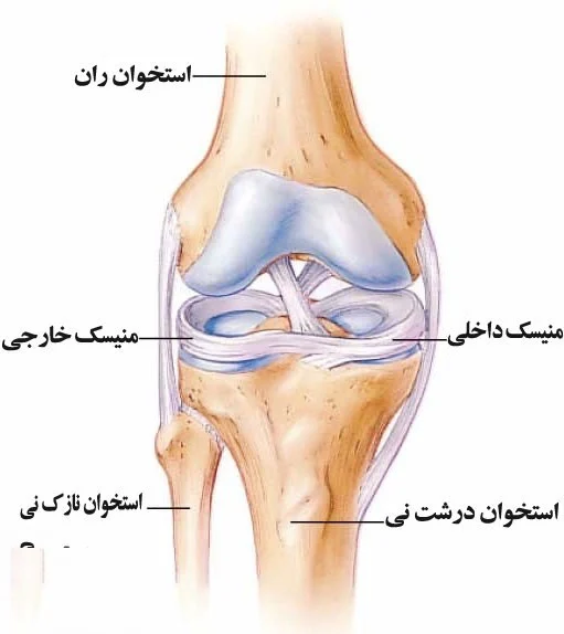 آسیب مینیسک - کلینیک فیزیوتراپی و توانبخشی رادان